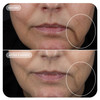 IMAGE Skincare VOL.U.LIFT™ GLP-1 4D Skin Rebound Complex