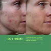 Murad Biome-Balancing Calm + Recover Cream M-BBCR 45