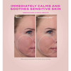 Heartleaf cream cheek before and immediately after calm comparison