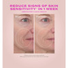 Heartleaf cream before and after 1 week sensitivity signs comparison