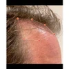 REVIAN Lyte Hair Growth Device