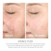 epionce study before and after 24 weeks cheek skin photos