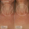 Neck before and after 7 weeks of Sente Neck Firming Cream
