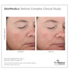 SkinMedica Retinol Complex