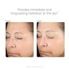 PCA Skin Hyaluronic Acid Boosting Serum baseline and 6 weeks photos, second subject