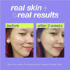 Dermalogica Clear Start Breakout Clearing Booster DMCS111286 BeautifiedYou.com