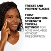 Model applying La Roche-Posay Effaclar Adapalene Gel to cheek with text overlay