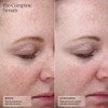 Bio Complete Serum before and after 8 weeks photos of facial redness