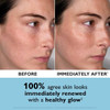 Before and immediately after photos of a woman's cheek