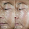 Senté Dermal Repair Ultra-Nourish before and after 12 weeks dry skin photos