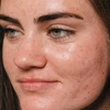 Close-up of a young woman's face with freckles and visible pores