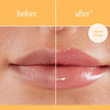 Before and after close-up of lips with GrandeLIPS gloss