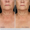 Obagi ELASTIderm Neck and Decollete Concentrate