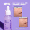 Dermalogica Clear Start Breakout Clearing Liquid Peel DMCS111464 BeautifiedYou.com