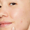 Woman with a small dot of product on her cheek
