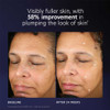 Baseline and after 24 weeks face photos, 58% improvement in plumping text