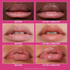 Three pairs of before and after 5 minutes lip photos
