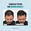 Nutrafol Men before and 6 months growing comparison photos of male hairline