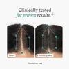 Nutrafol Women before and after 6 months hair part photos