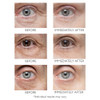 Three before and immediately after close-ups of under-eye areas with Instant FirmX Eye