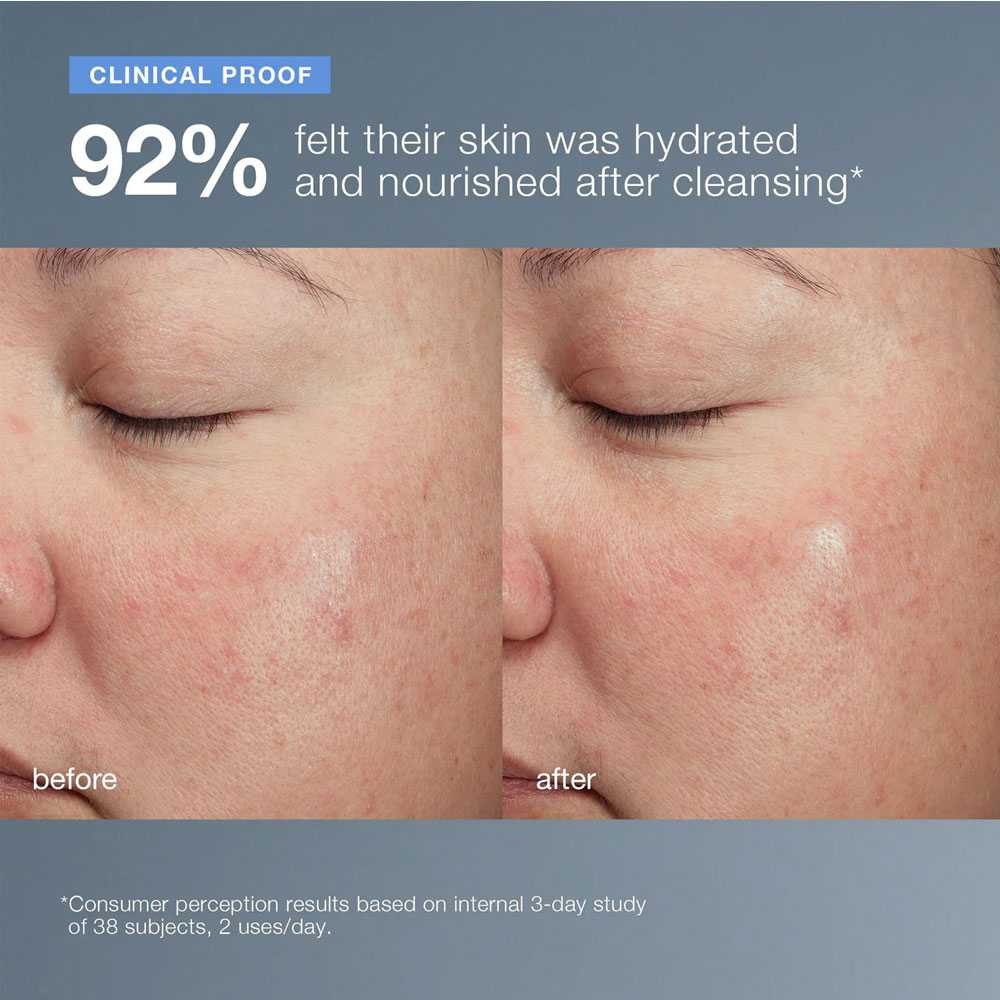 Before and after cheek photos with 92% hydrated survey text