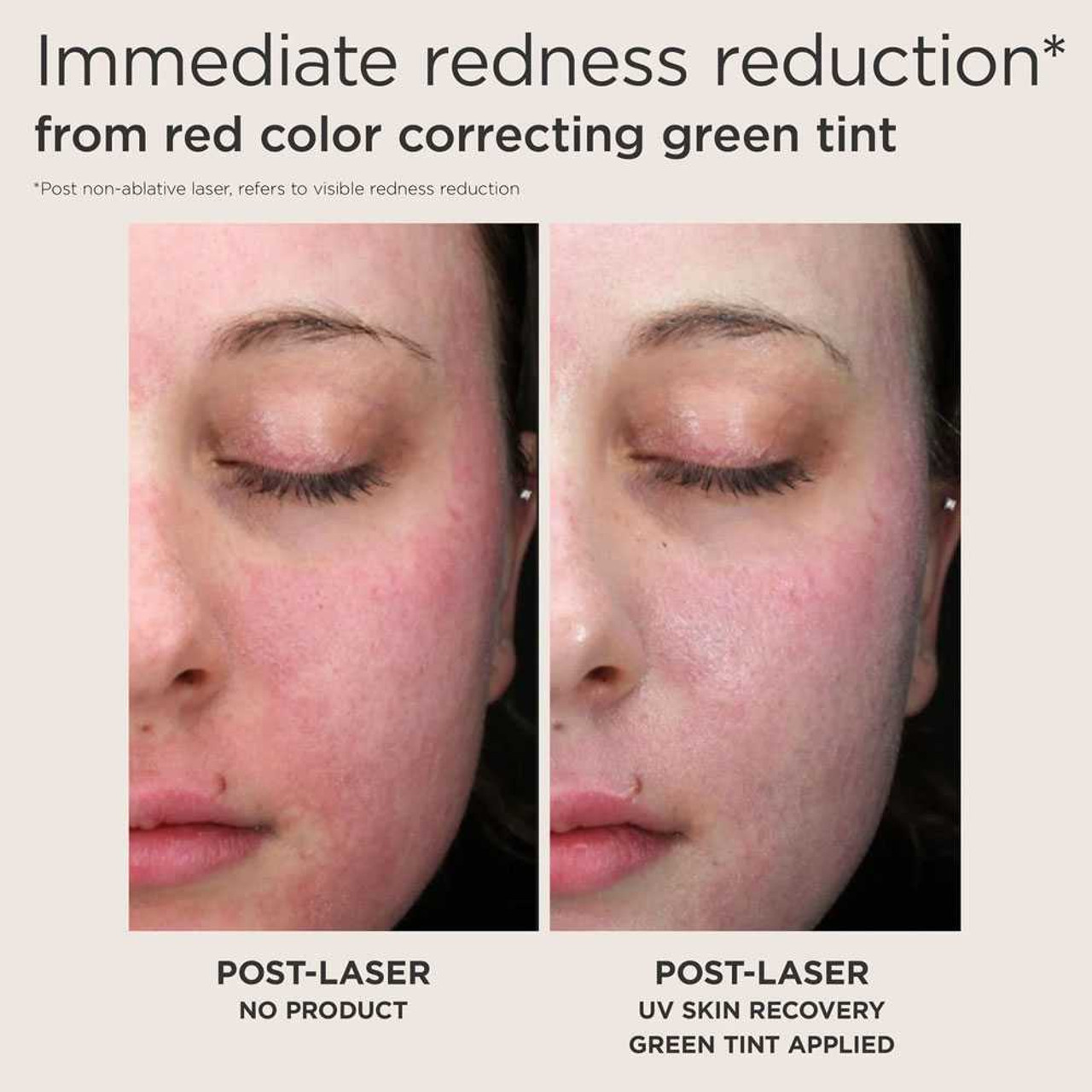 EltaMD UV Skin Recovery SPF 50 ELMD-SkinRecovery BeautifiedYou.com