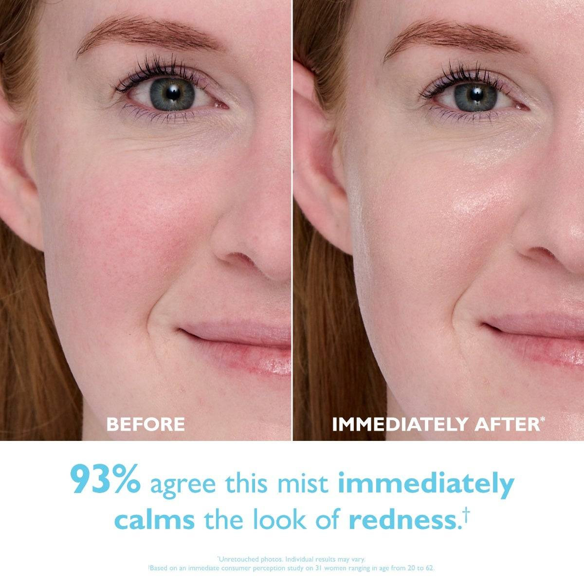 Before and immediately after photos of a woman's cheek, cooling mist results graphic