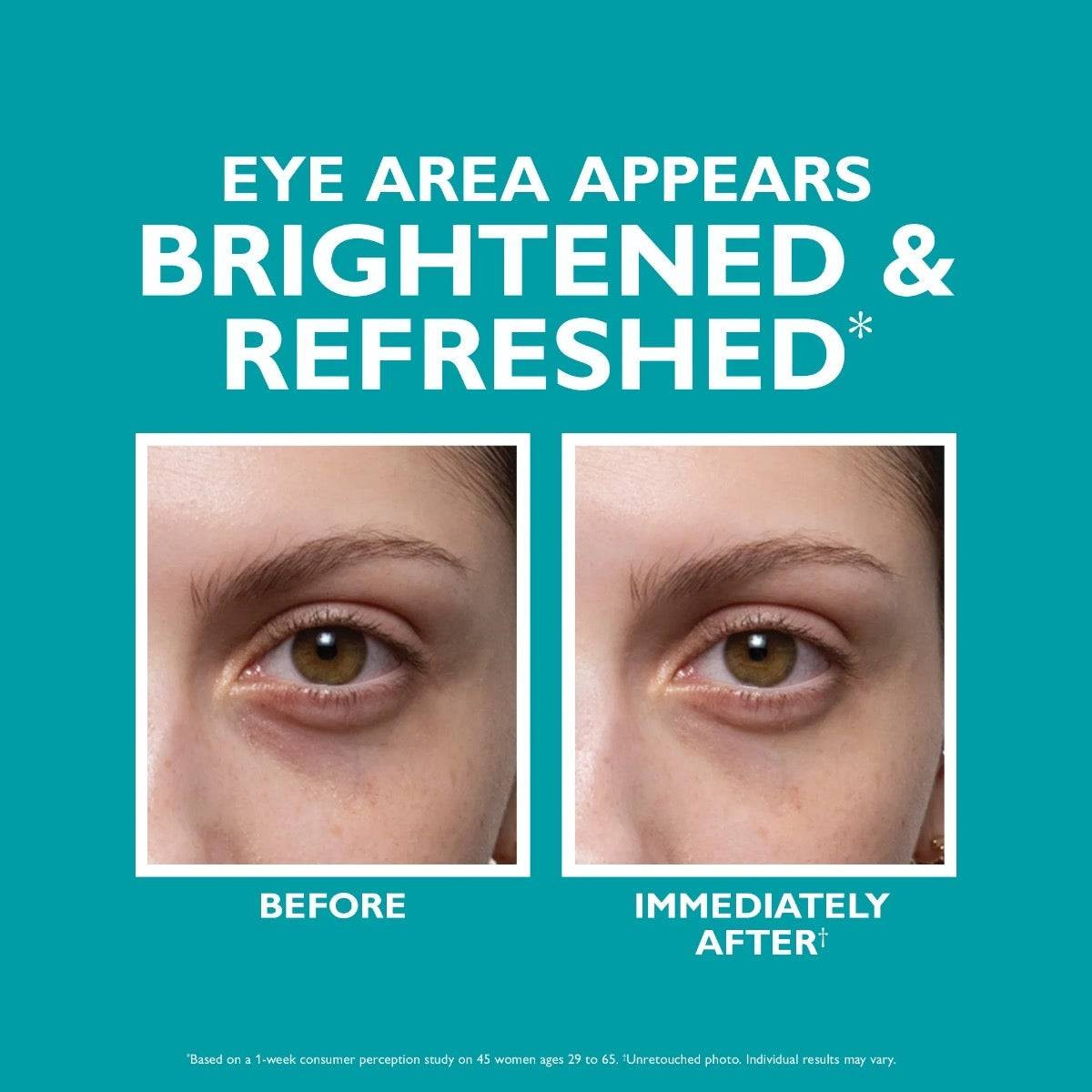Before and after photos of an under-eye area, brightened and refreshed
