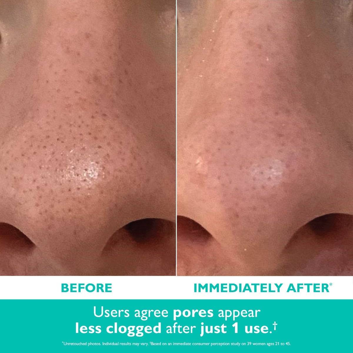 Peter Thomas Roth Even Smoother Microdermabrasion Exfoliating Pore Purifier