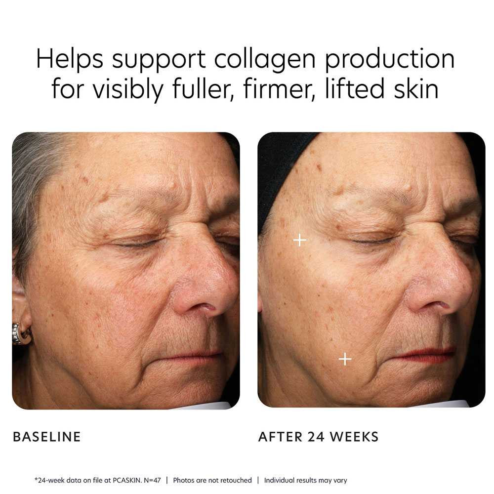 PCA Skin MGF Age Renewal Cream PCA21157 BeautifiedYou.com