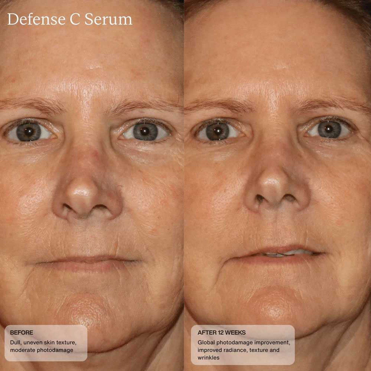 Sente Defense C Serum with HSA SN17233 165