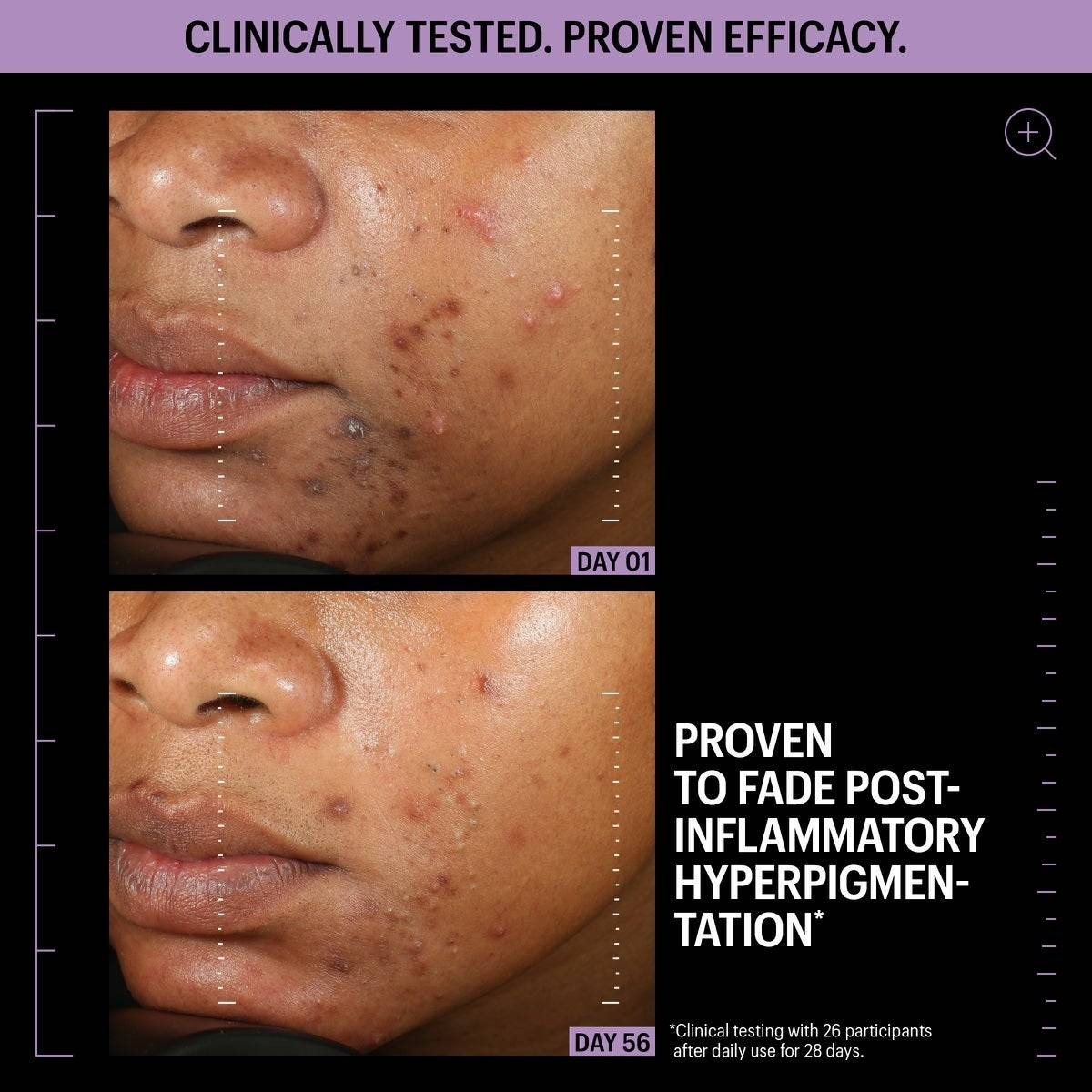 Day 1 and day 14 skin tone comparison, Allies of Skin clinical results