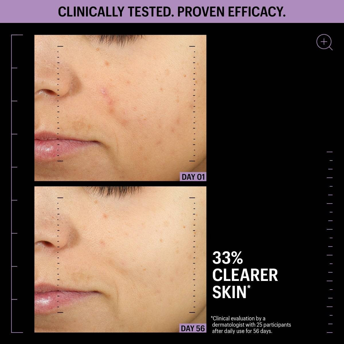 Day 1 and day 14 skin clarity comparison, Allies of Skin clinical results