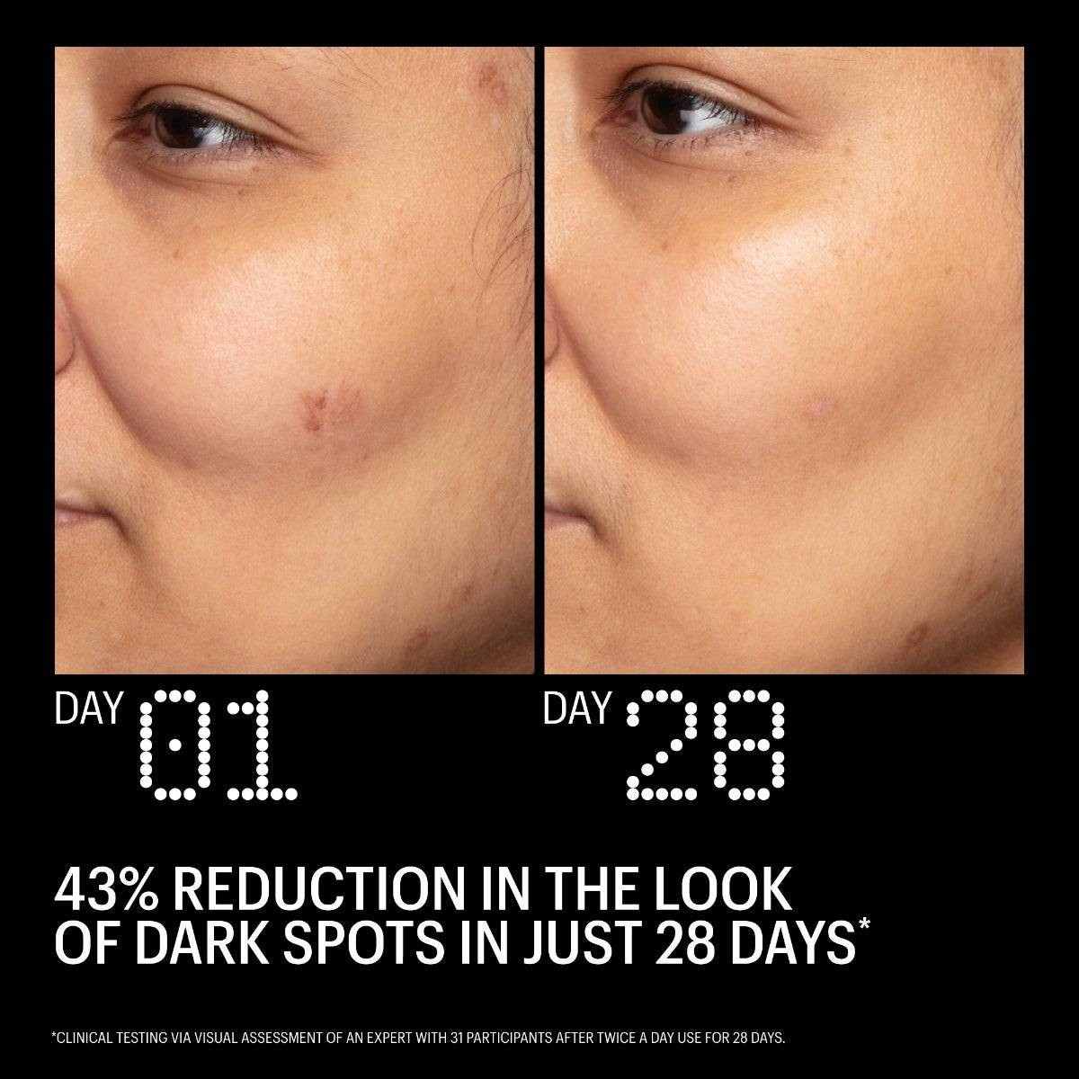 Day 1 and day 28 dark spot comparison, Allies of Skin results