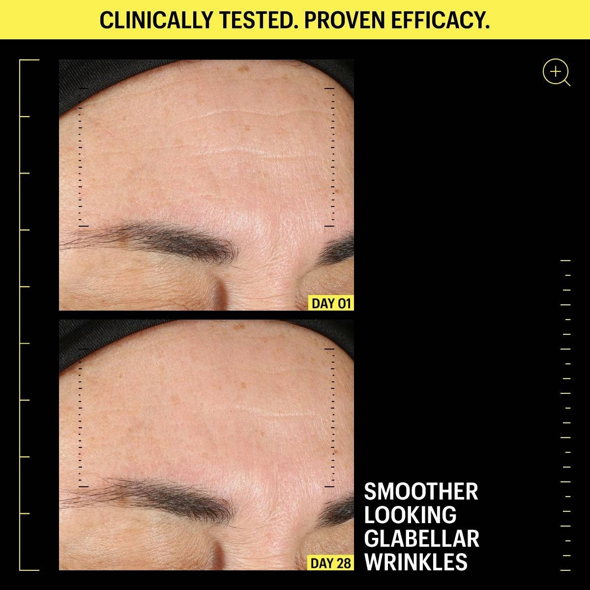 Day 1 and day 28 close-up photos of forehead lines, clinically tested graphic