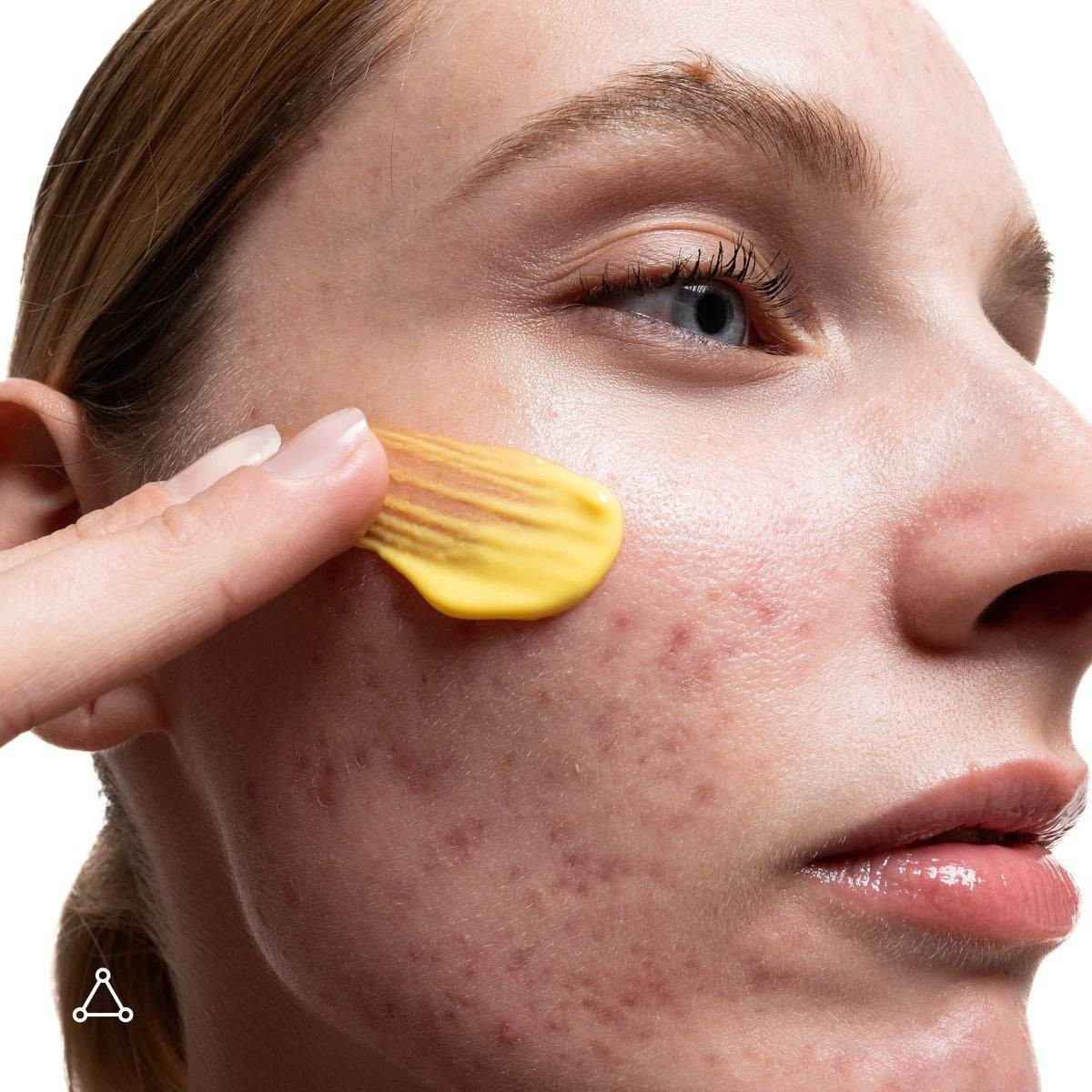 Model applying yellow retinal night cream to her cheek
