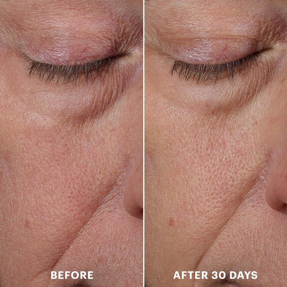 glo Skin Beauty Bio-Renew EGF Rich Repair Cream