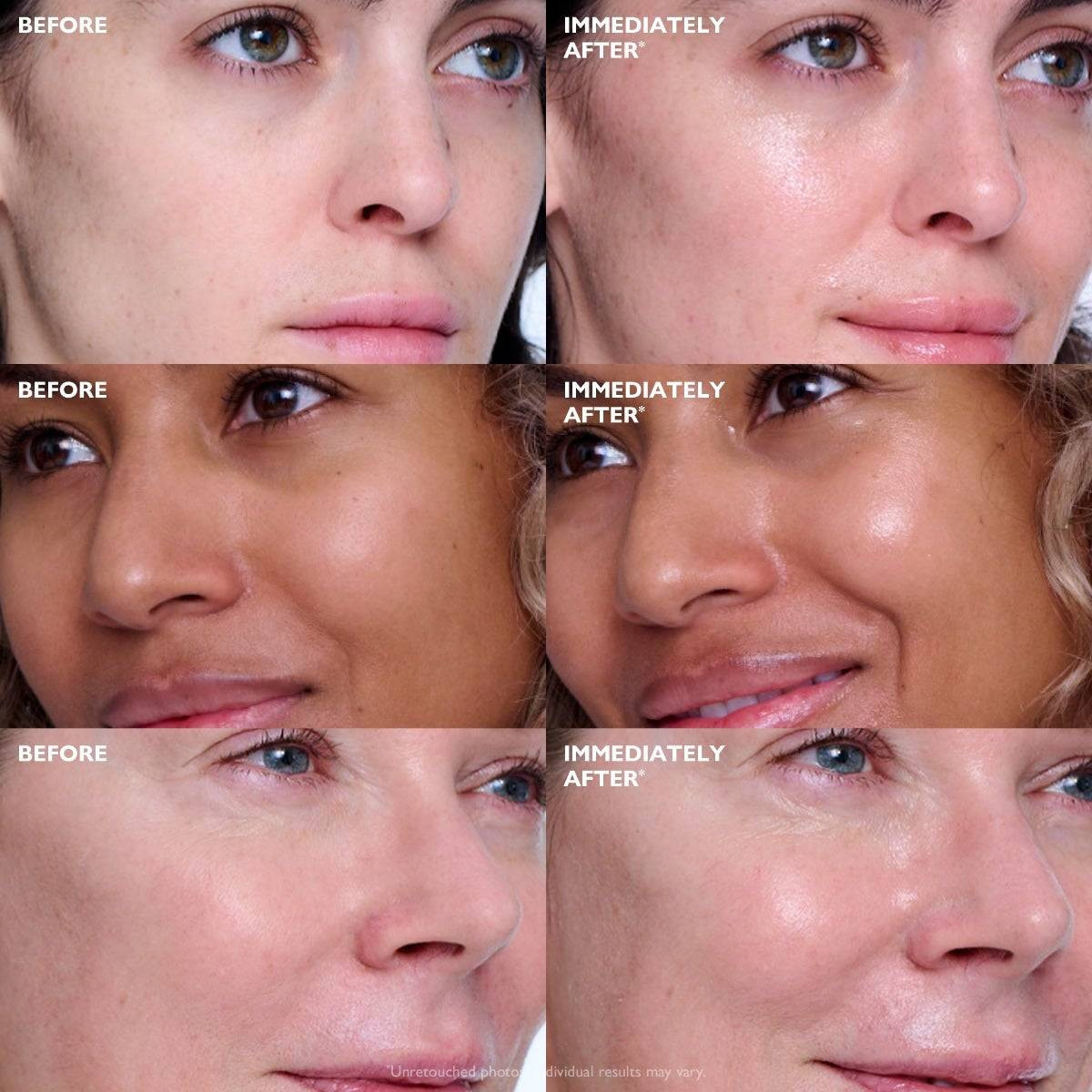 Peter Thomas Roth Collagen Skinjection Plumping & Firming Serum PTR51309 65