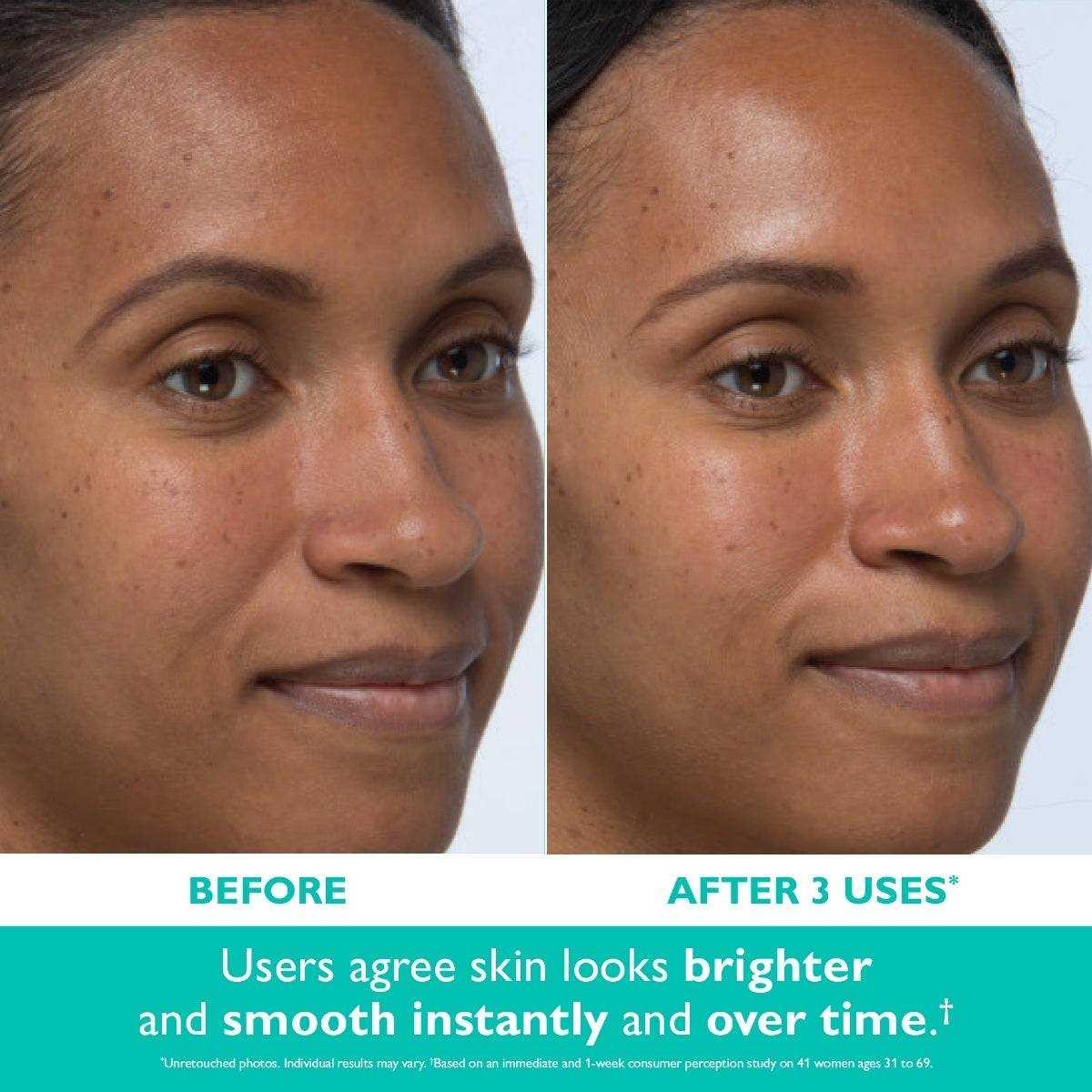 Even Smoother before and after 3 uses brighter smoother skin comparison