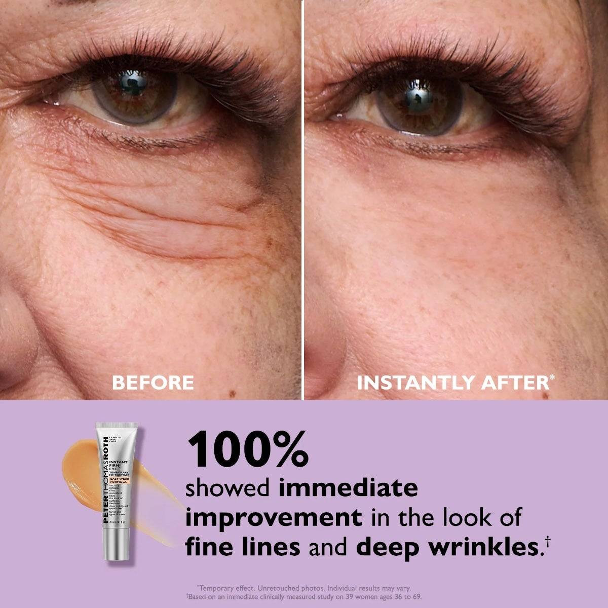 Close-up before and instantly after eye photos, 100% showed immediate improvement graphic