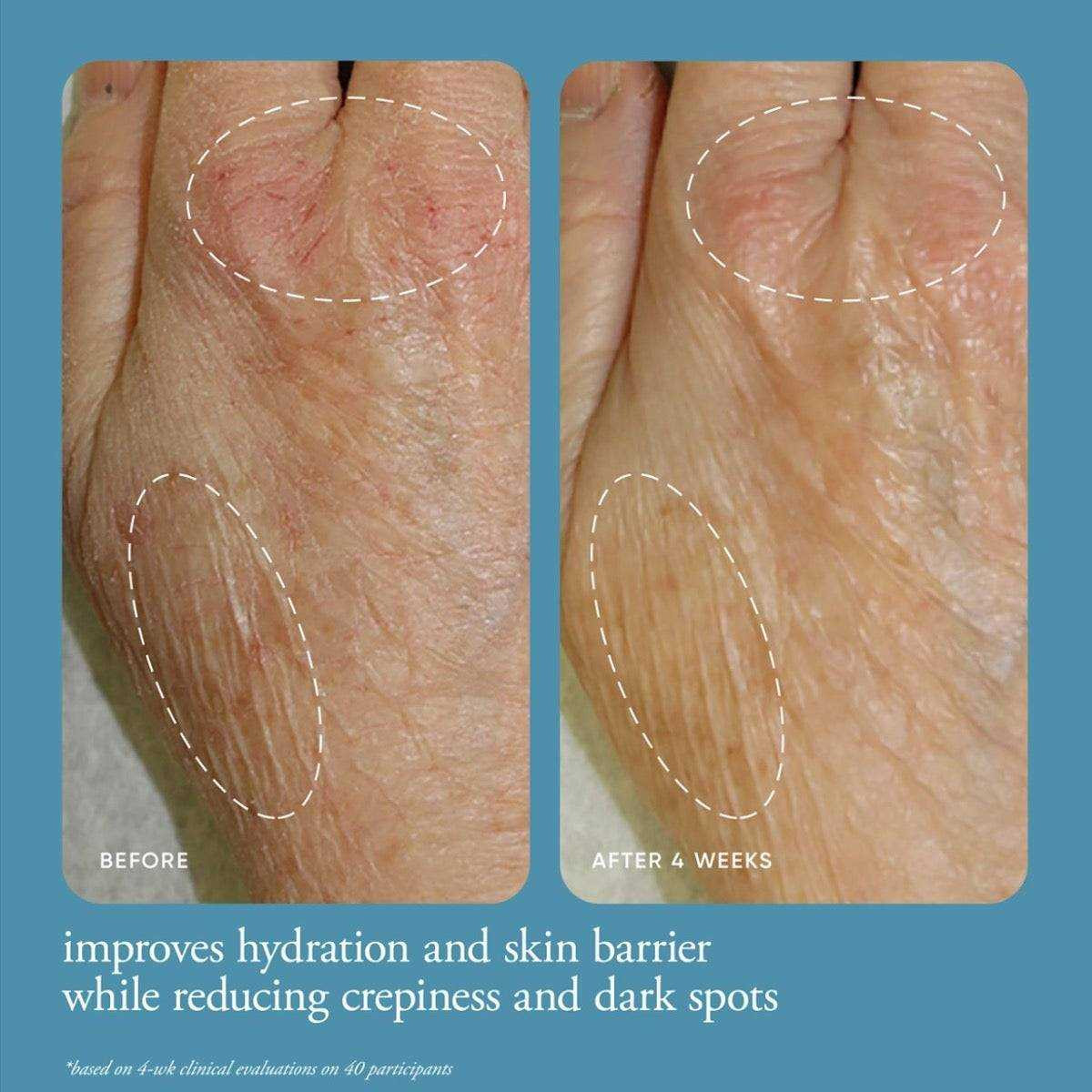 In good hands before and after hand crepiness results graphic