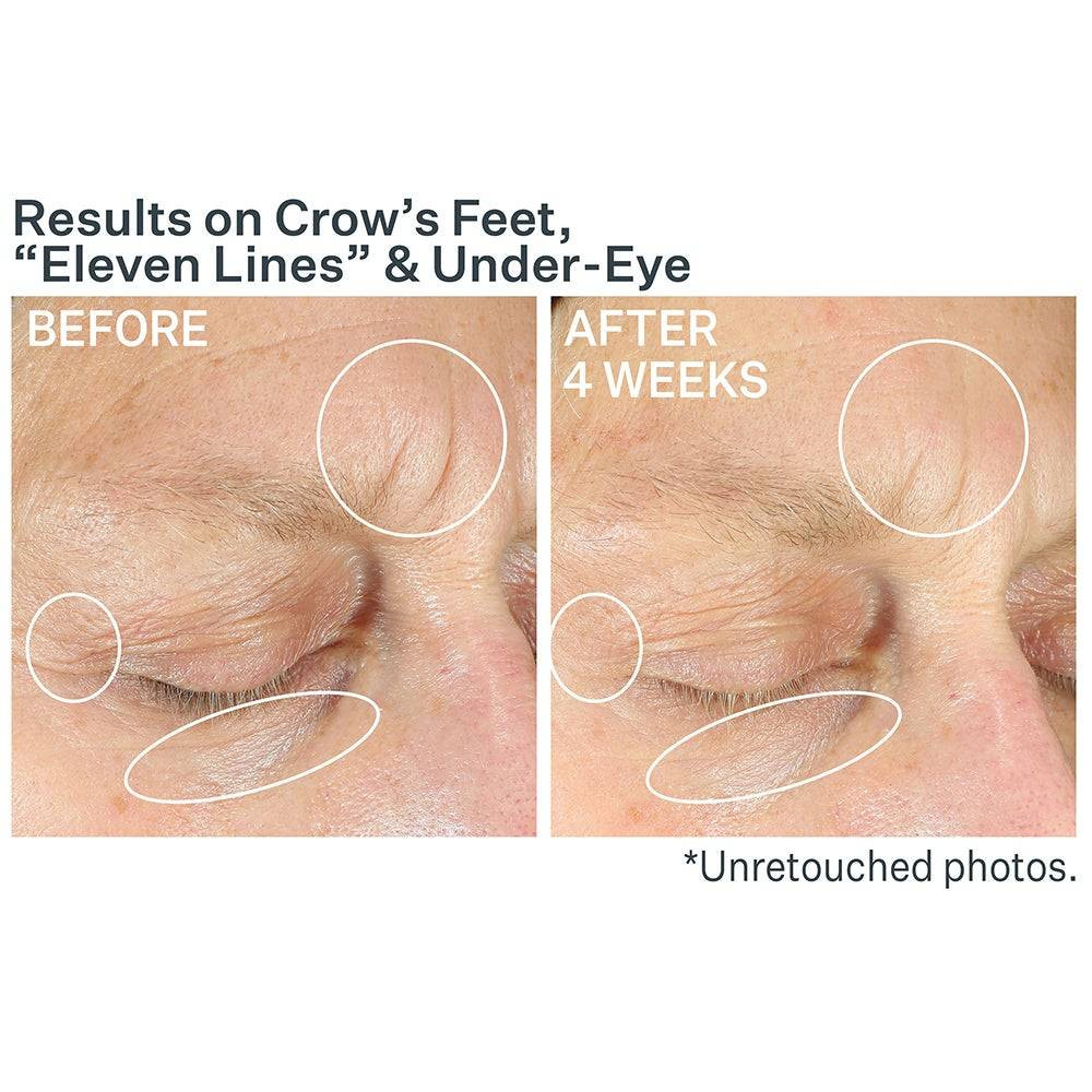 Strivectin Anti-Wrinkle Intensive Eye Concentrate For Wrinkles PLUS SV22940 82