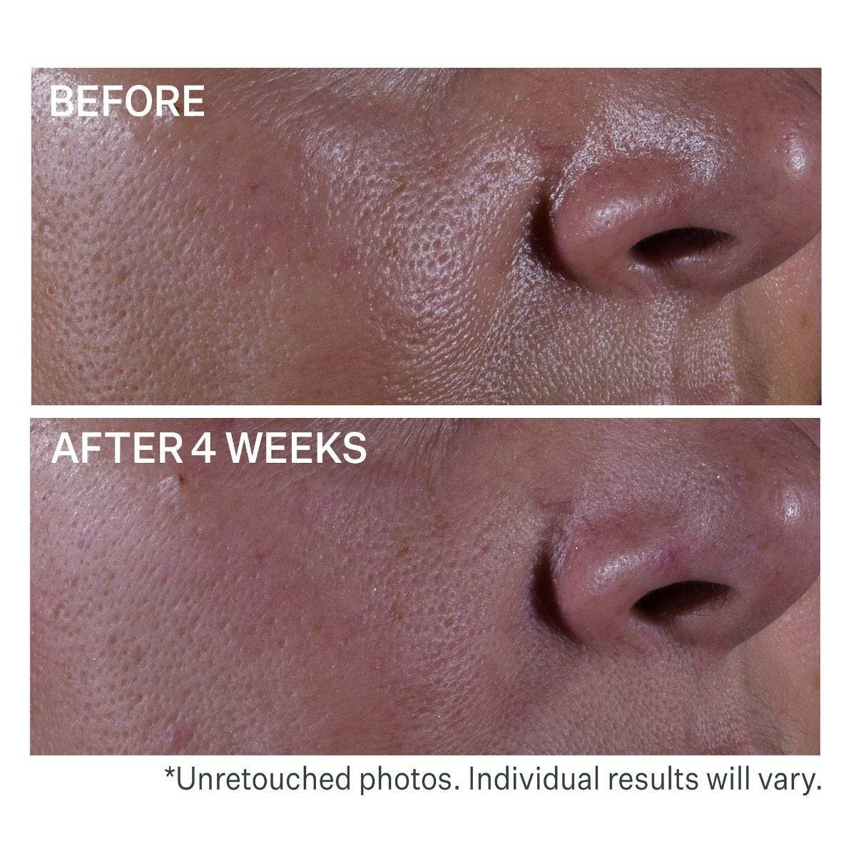 StriVectin Multi-Action Super Shrink Pore Minimizing Serum SV24968 72