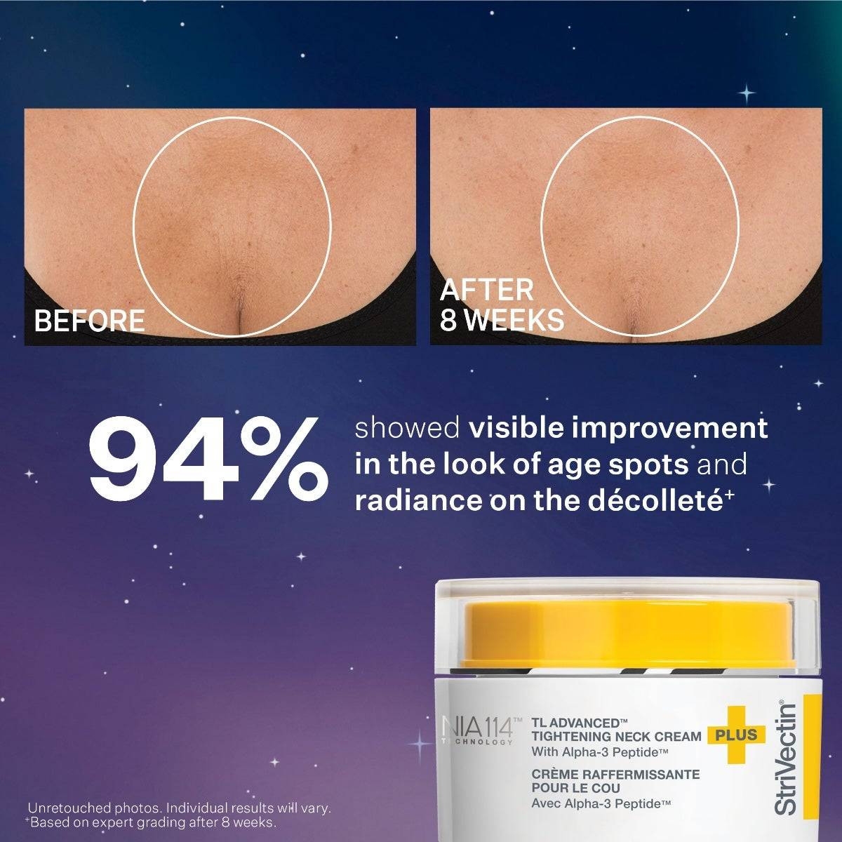 StriVectin Tighten & Sculpt Duo Kit (Limited Edition) SV01772 99