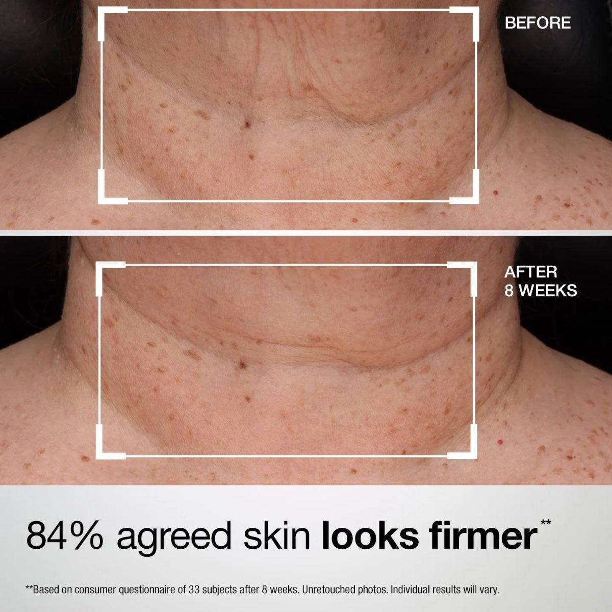 StriVectin TL Advanced Tightening Neck & Chest Lotion SPF 35 SV03141 75