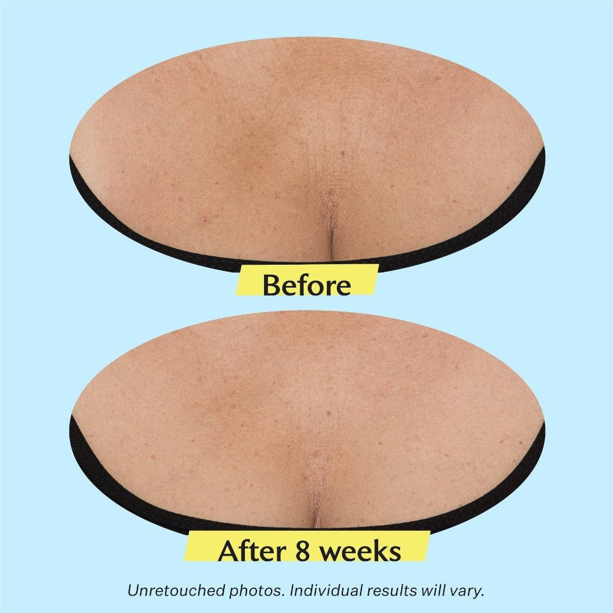 StriVectin TL Advanced Tightening Neck Cream PLUS Alpha-3 Peptide SV27211 159