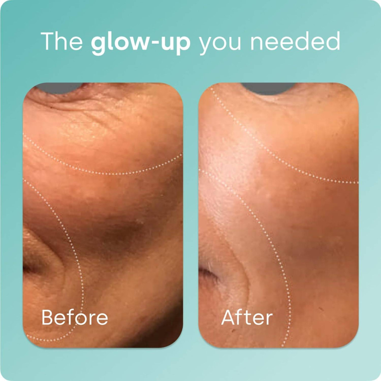 Biosil Advanced Collagen Generator, Original Capsules