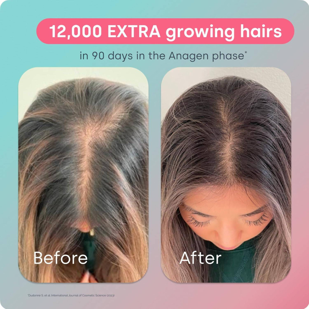 Biosil Advanced Hair Growth - 30 Packets