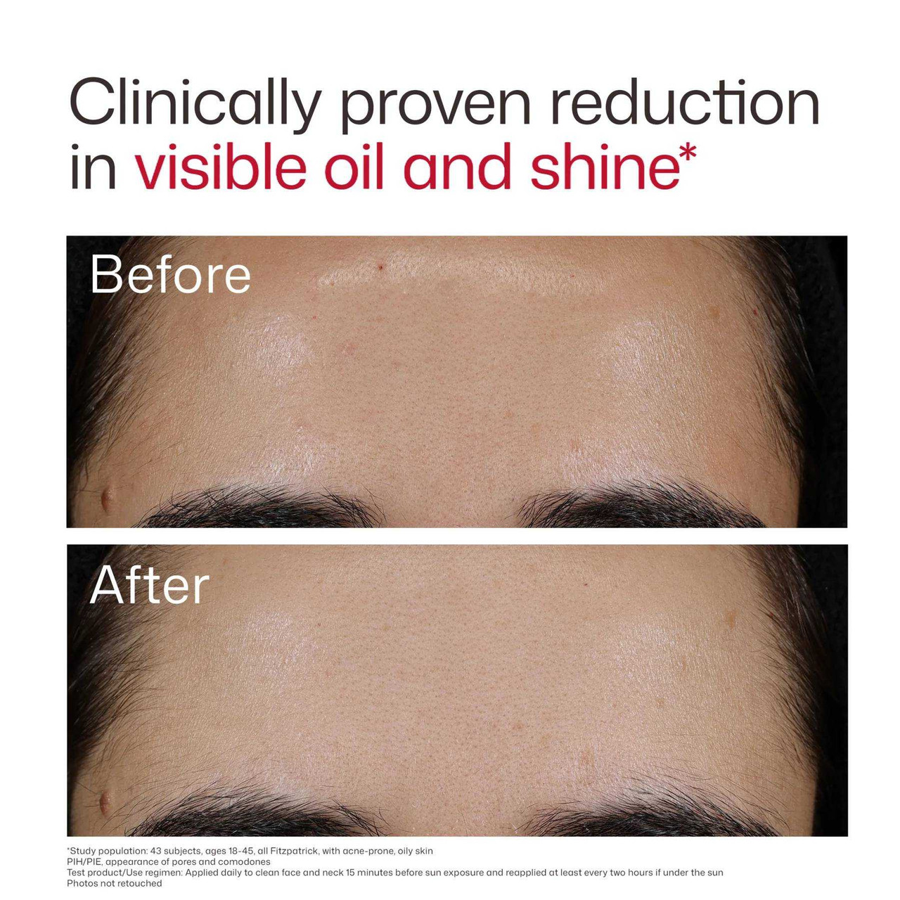 EltaMD UV Clear Blemish-Prone & Oil Balancing SPF 50 ELMD-BPO 98