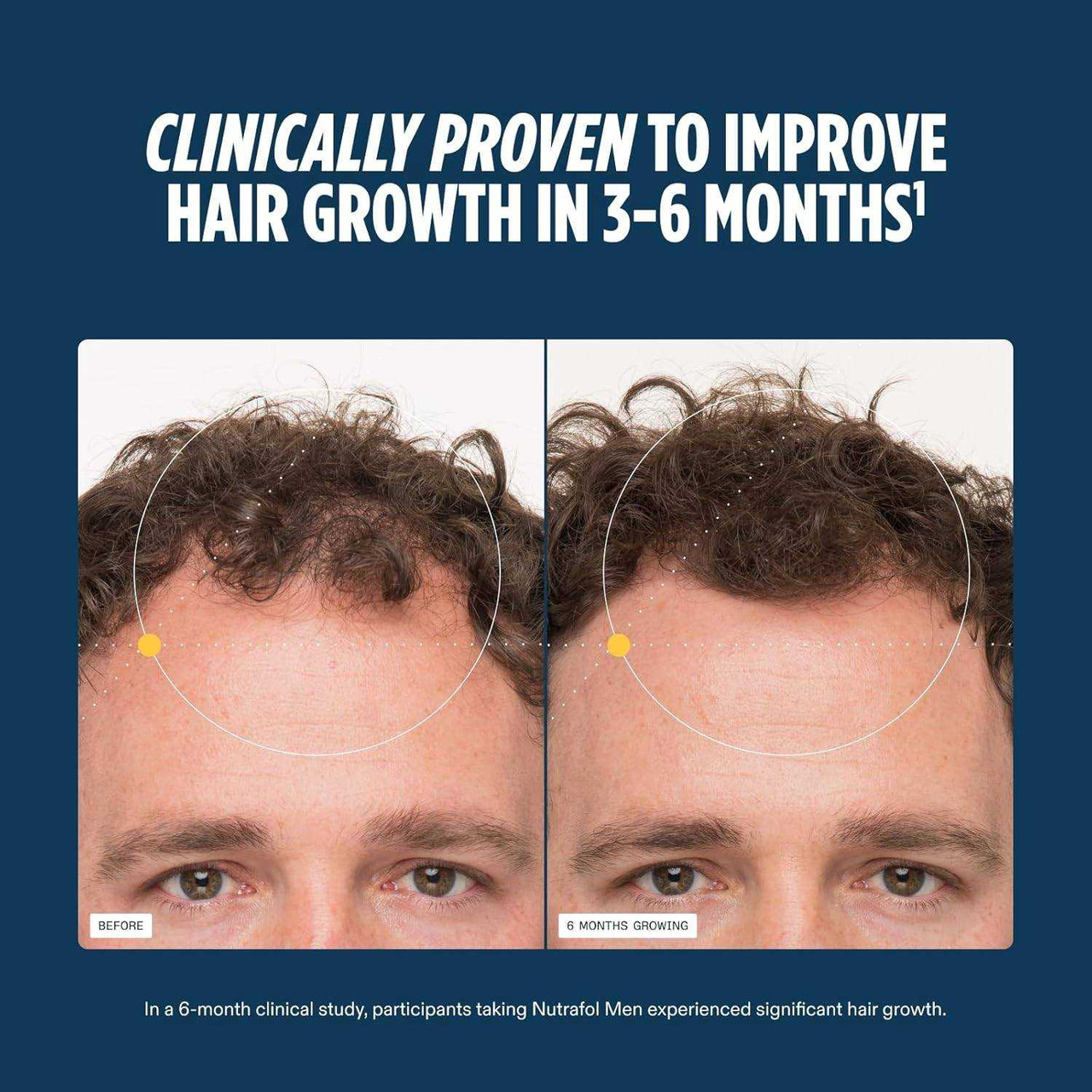 Nutrafol Men's Fullest Hair Kit NTF11838 258